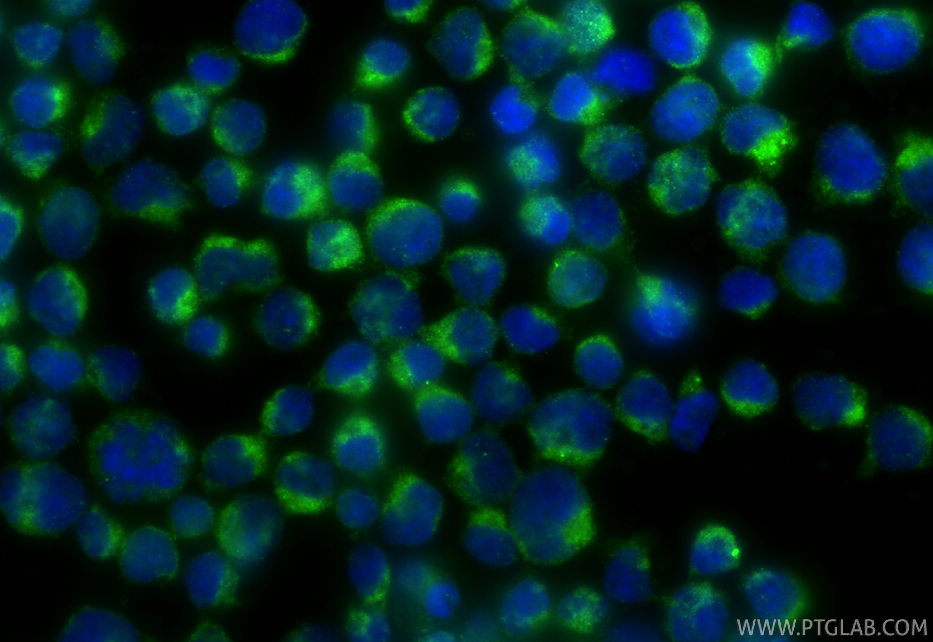 Immunofluorescence (IF) / fluorescent staining of Jurkat cells using SLC25A46 Polyclonal antibody (12277-1-AP)