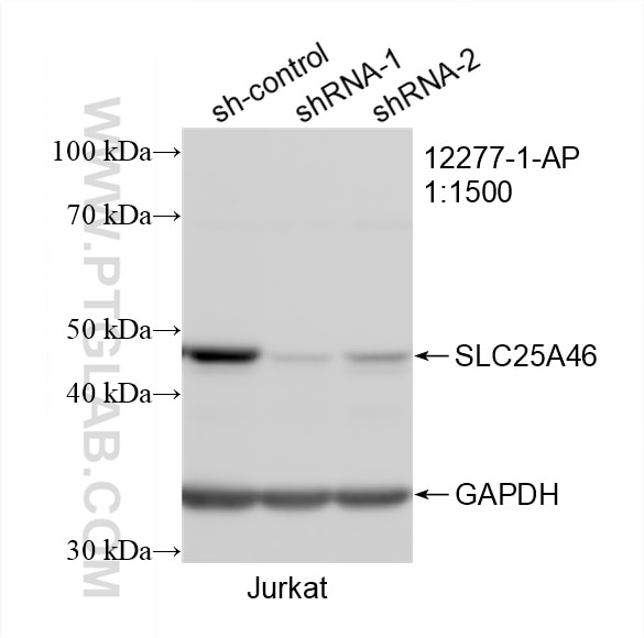 Western Blot (WB) analysis of Jurkat cells using SLC25A46 Polyclonal antibody (12277-1-AP)