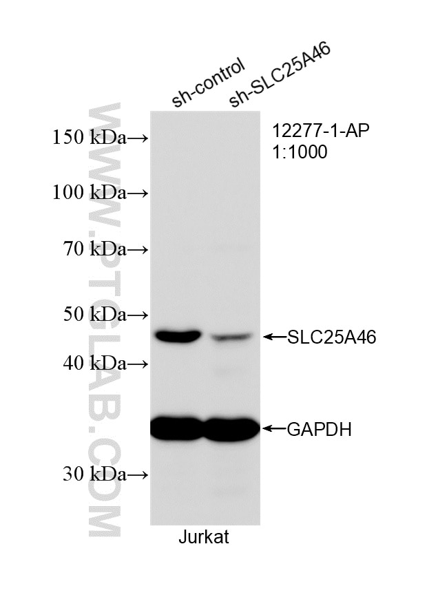 WB result of SLC25A46 antibody (12277-1-AP; 1:1000; incubated at room temperature for 1.5 hours) with sh-Control and sh-SLC25A46 transfected Jurkat cells. Western Blot (WB) analysis of Jurkat cells using SLC25A46 Polyclonal antibody (12277-1-AP)