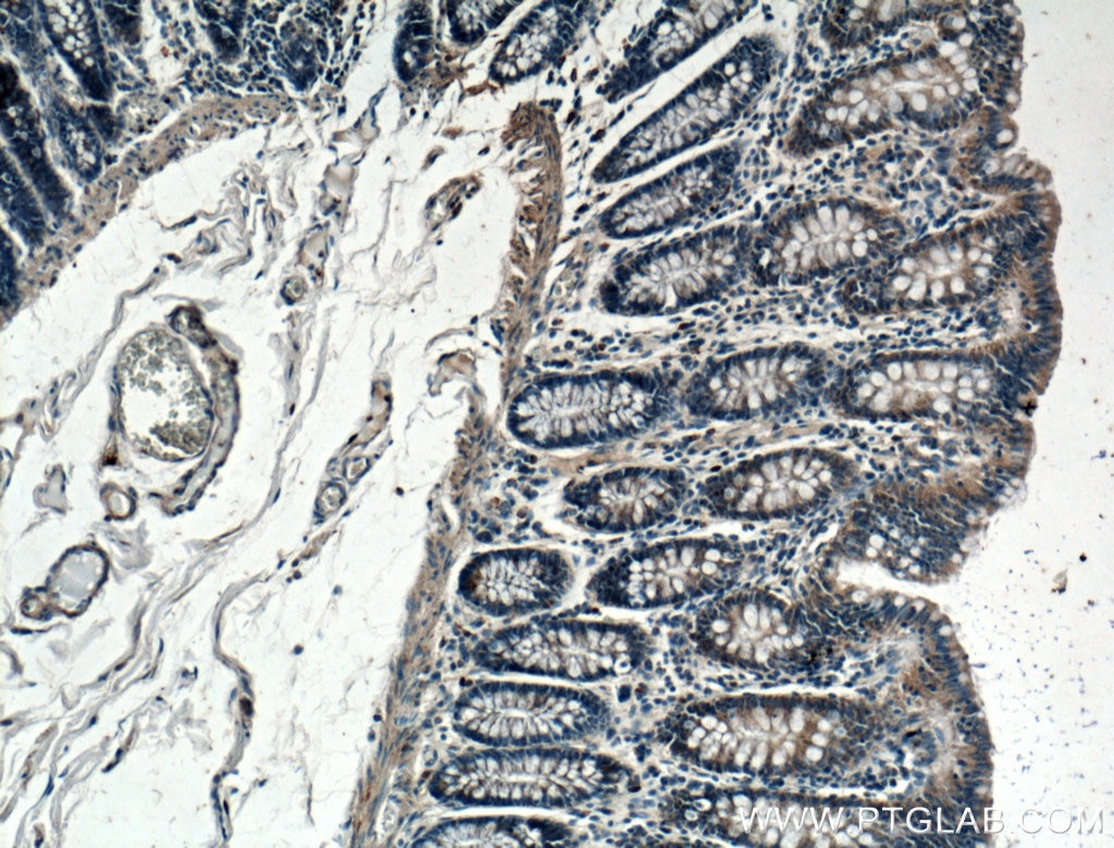 Immunohistochemistry (IHC) staining of human colon tissue using SLC25A46 Polyclonal antibody (27869-1-AP)