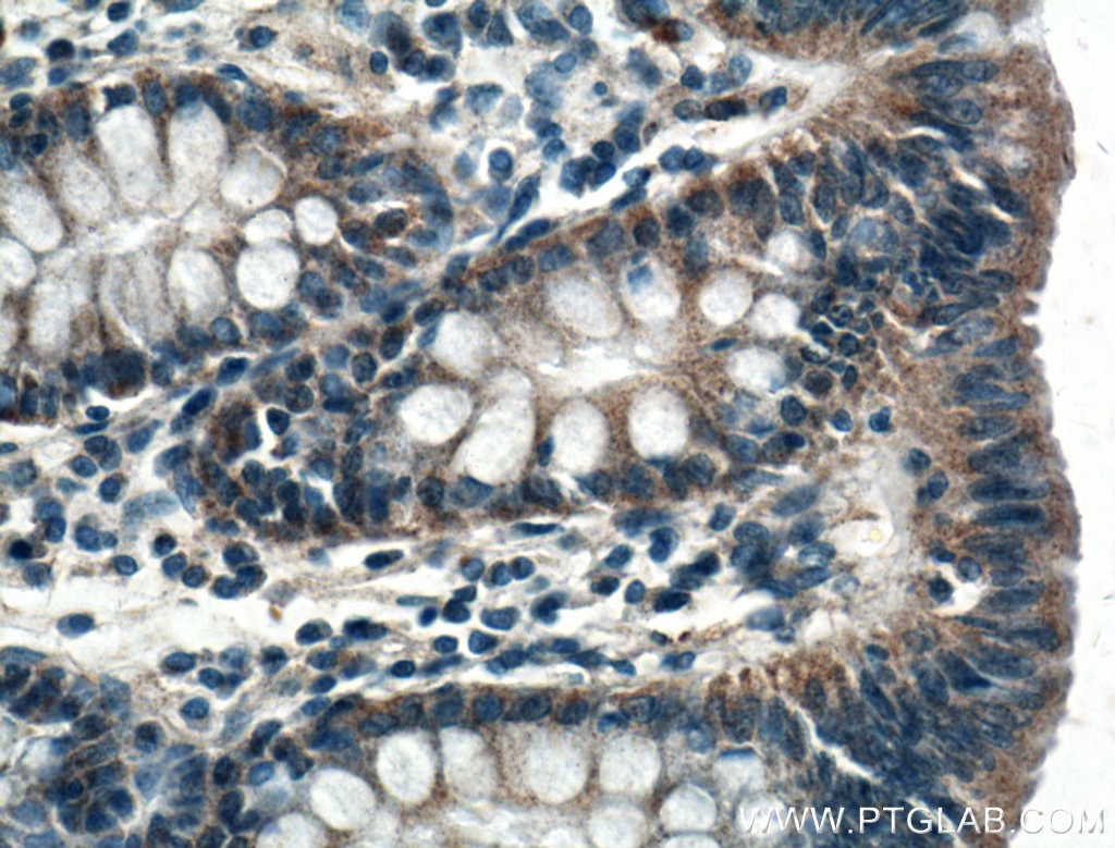 Immunohistochemistry (IHC) staining of human colon tissue using SLC25A46 Polyclonal antibody (27869-1-AP)