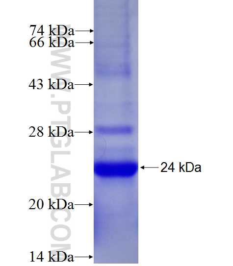 SLC25A46 fusion protein Ag27293 SDS-PAGE