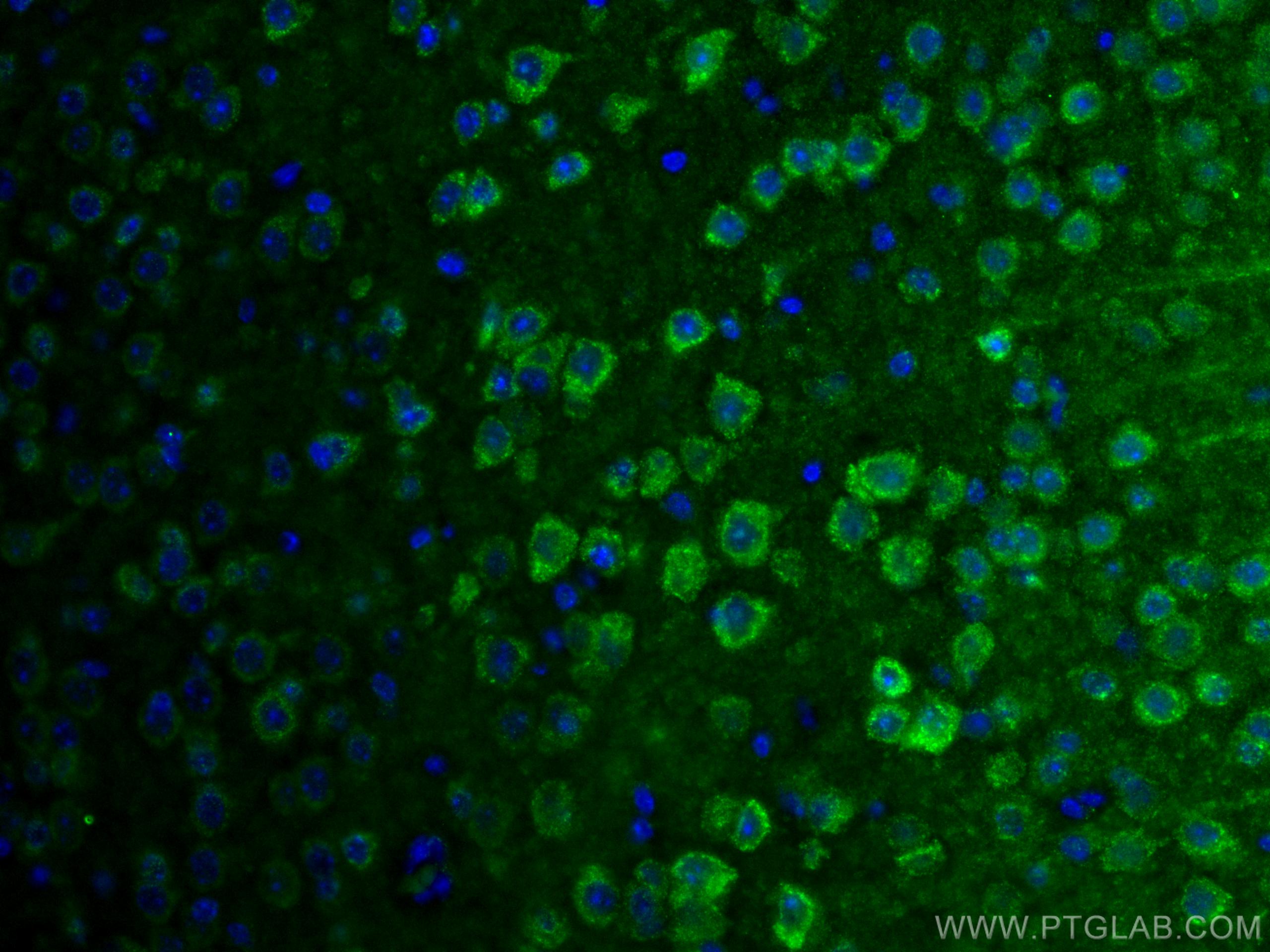 Immunofluorescence (IF) / fluorescent staining of mouse brain tissue using SLC25A47 Polyclonal antibody (26292-1-AP)