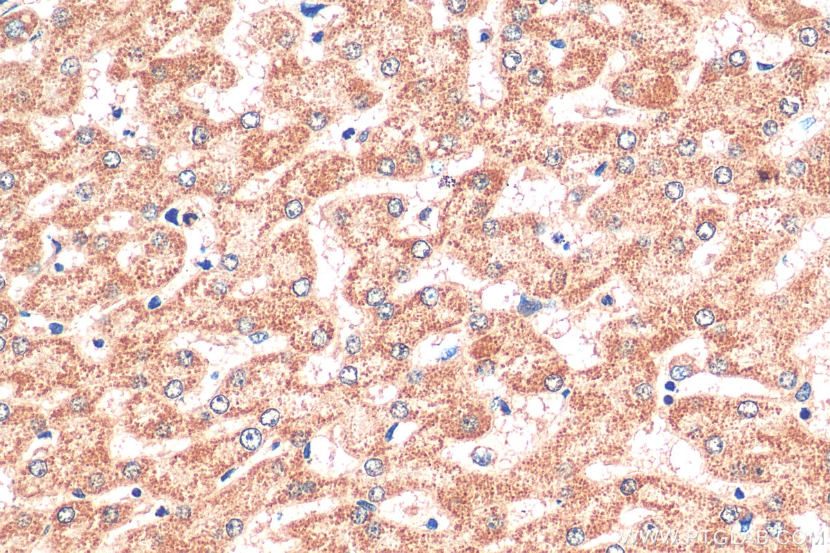 Immunohistochemistry (IHC) staining of human liver tissue using SLC25A47 Polyclonal antibody (26292-1-AP)