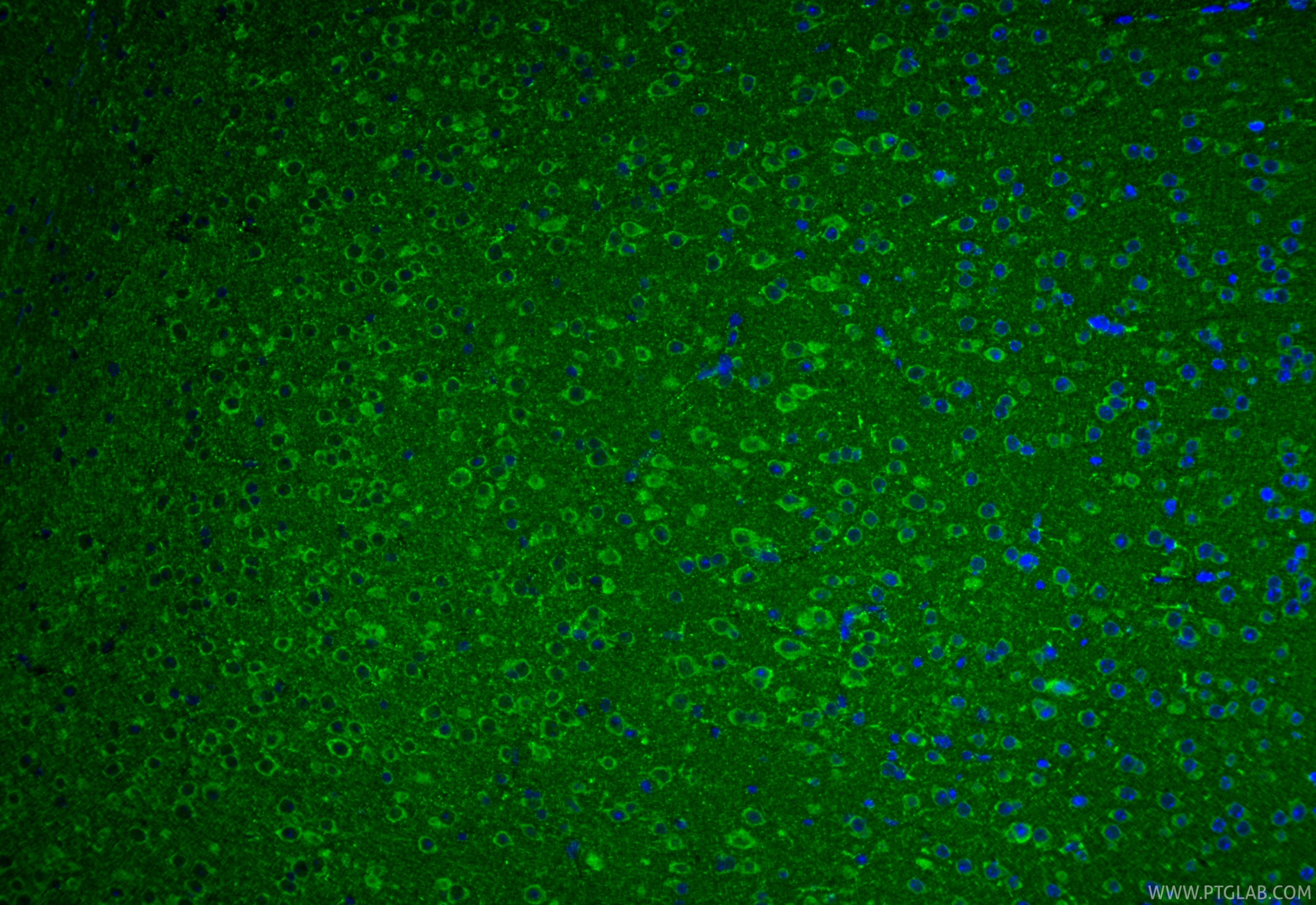 Immunofluorescence (IF) / fluorescent staining of mouse brain tissue using ANT1/2 Polyclonal antibody (17796-1-AP)
