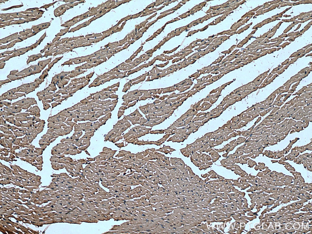 IHC staining of mouse heart using 17796-1-AP