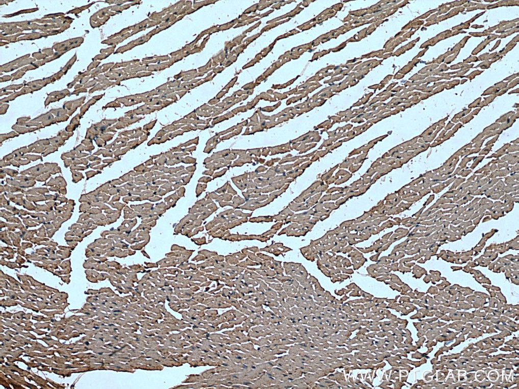 Immunohistochemistry (IHC) staining of mouse heart tissue using ANT1/2 Polyclonal antibody (17796-1-AP)