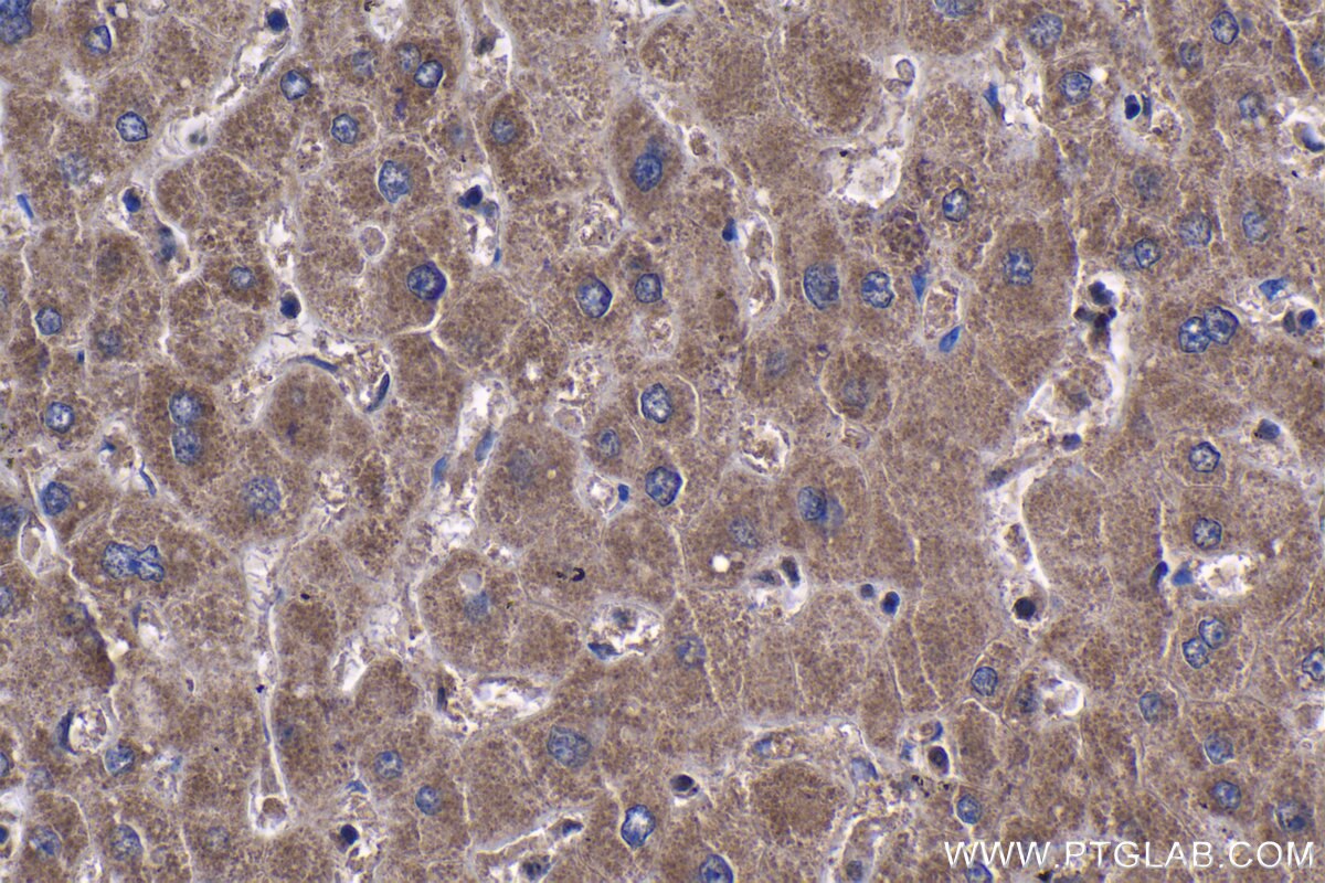 Immunohistochemistry (IHC) staining of human liver tissue using ANT1/2 Polyclonal antibody (17796-1-AP)