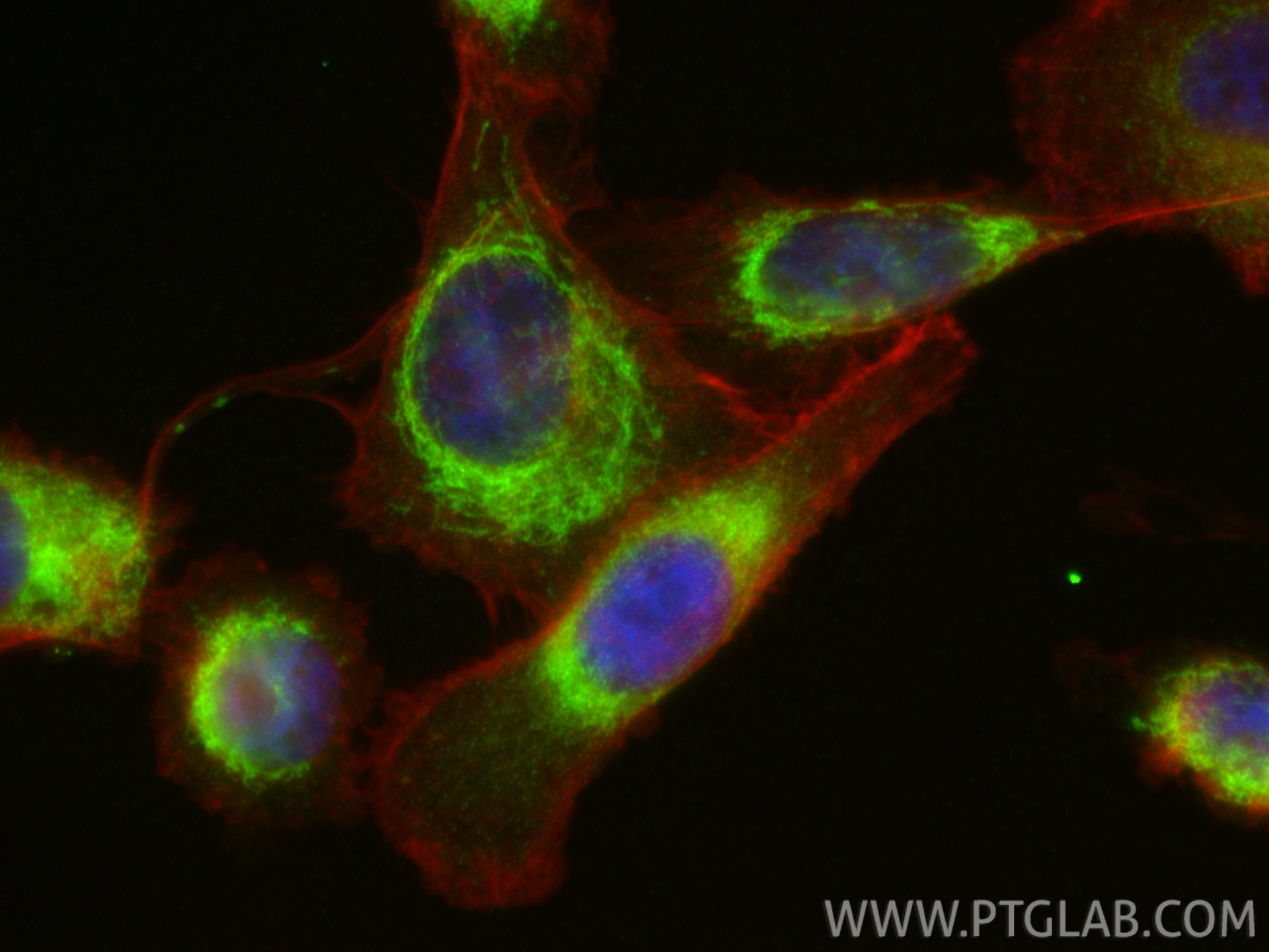 IF Staining of PC-3 using 83104-1-RR (same clone as 83104-1-PBS) Immunofluorescence (IF) / fluorescent staining of PC-3 cells using ANT1/2 Recombinant monoclonal antibody (83104-1-RR)