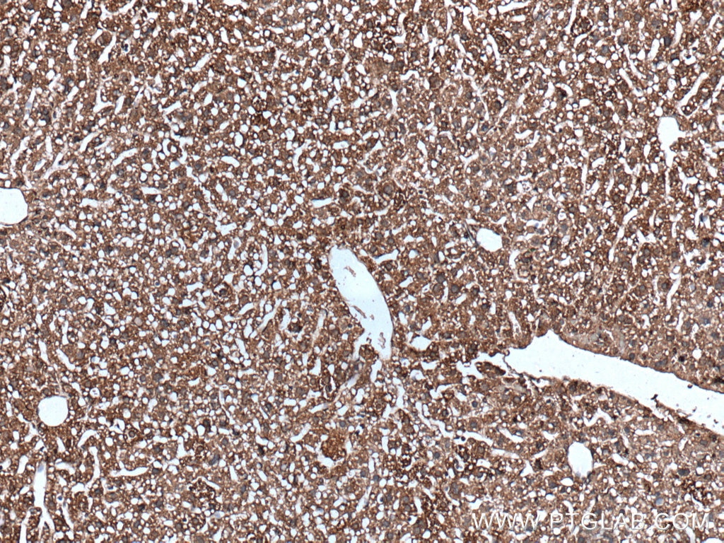 Immunohistochemistry (IHC) staining of mouse liver tissue using SLC25A6 Polyclonal antibody (51031-1-AP)