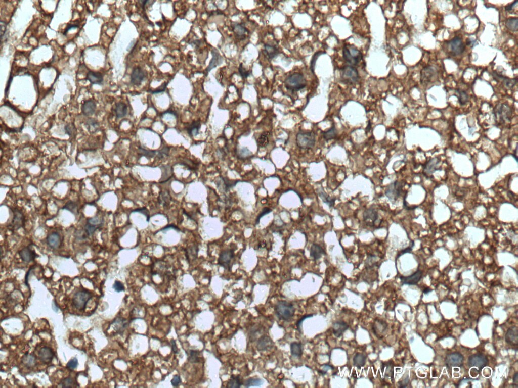 Immunohistochemistry (IHC) staining of mouse liver tissue using SLC25A6 Polyclonal antibody (51031-1-AP)