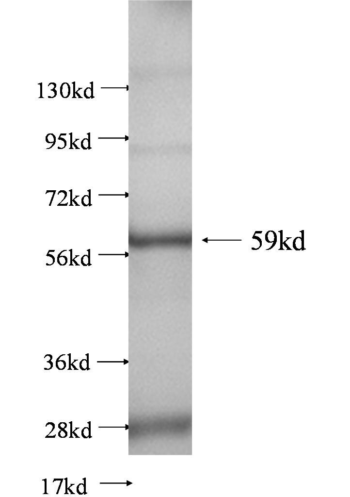 SLC25A6 fusion protein Ag0620 SDS-PAGE