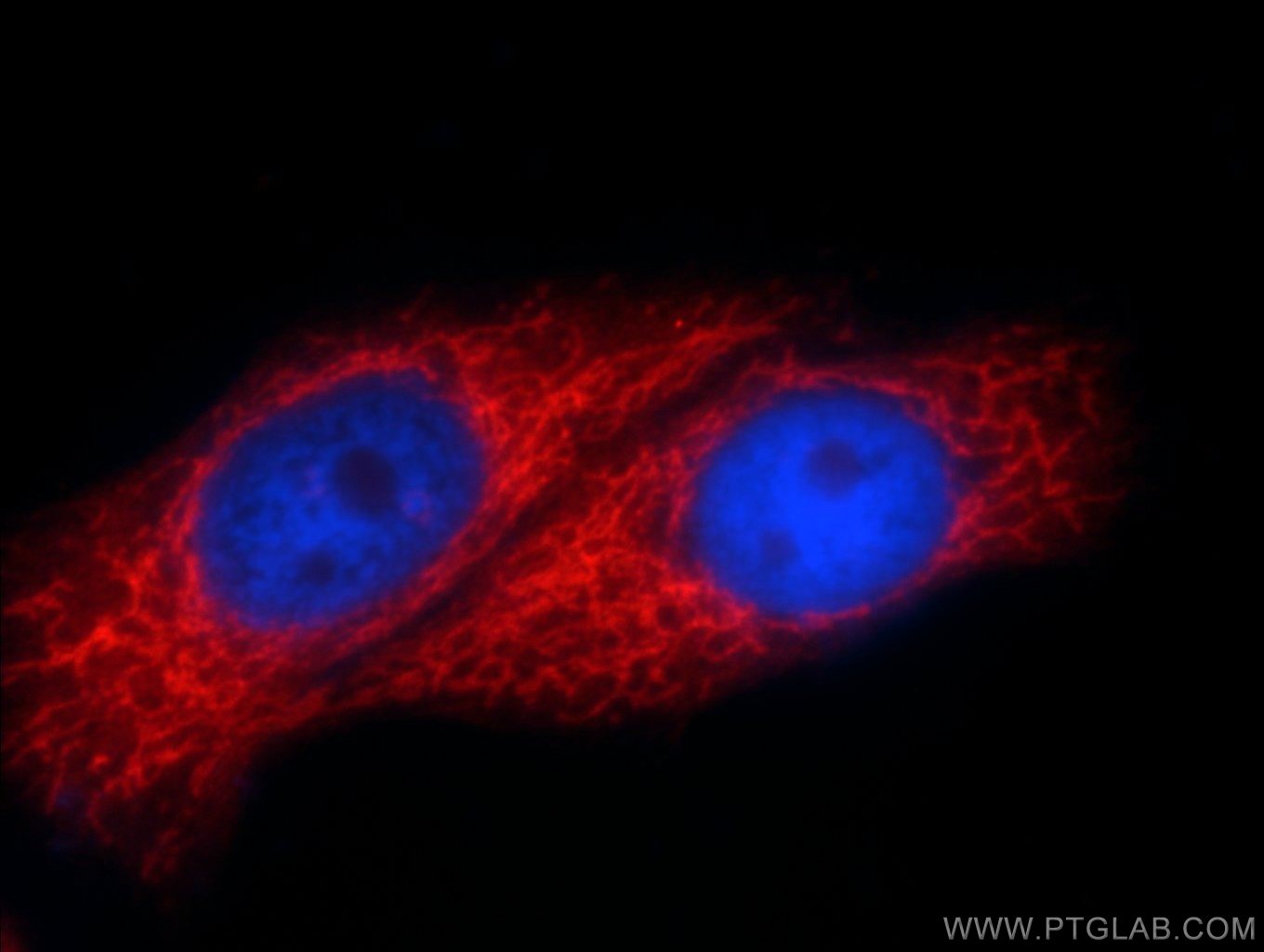 Immunofluorescence (IF) / fluorescent staining of HepG2 cells using SLC25A6-Specific Polyclonal antibody (14841-1-AP)
