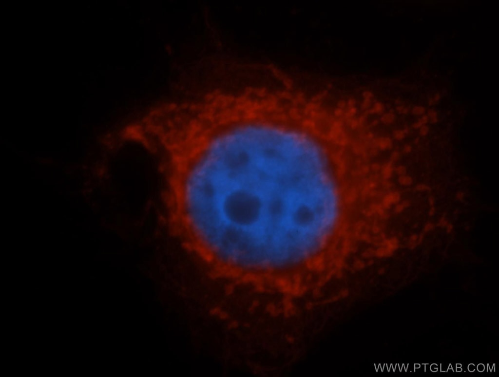 Immunofluorescence (IF) / fluorescent staining of MCF-7 cells using SLC25A6-Specific Polyclonal antibody (14841-1-AP)