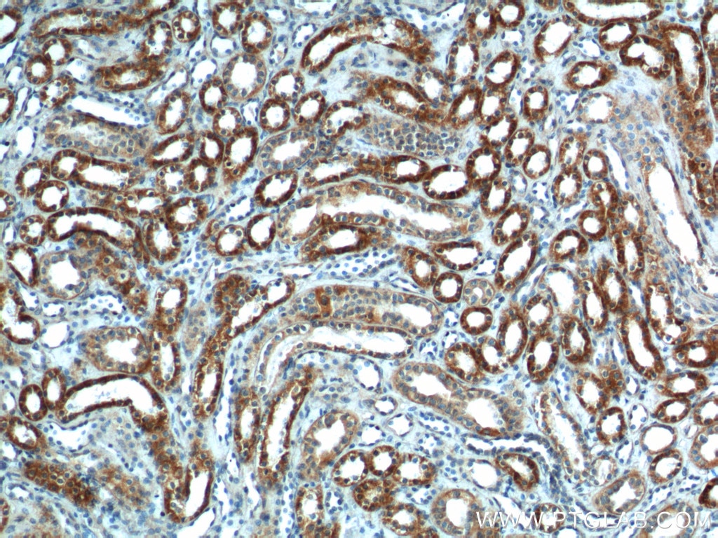 IHC staining of human kidney using 14841-1-AP