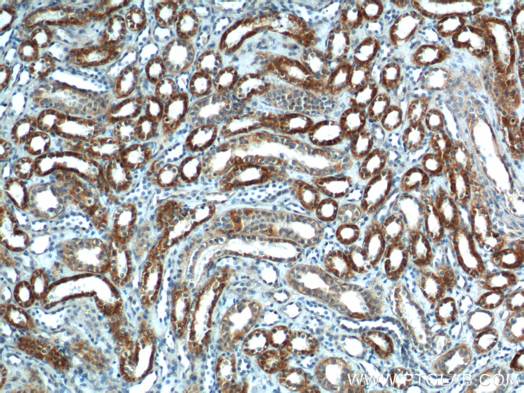 Immunohistochemistry (IHC) staining of human kidney tissue using SLC25A6-Specific Polyclonal antibody (14841-1-AP)