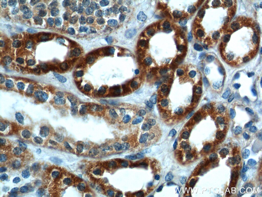 Immunohistochemistry (IHC) staining of human kidney tissue using SLC25A6-Specific Polyclonal antibody (14841-1-AP)