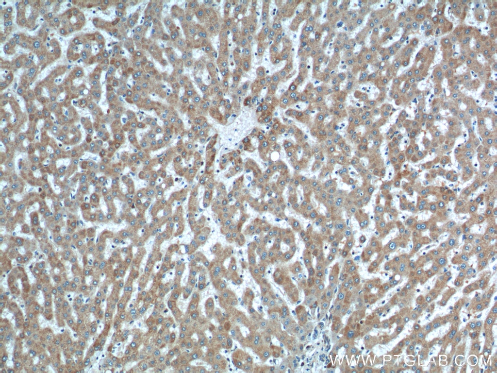IHC staining of human liver using 14841-1-AP