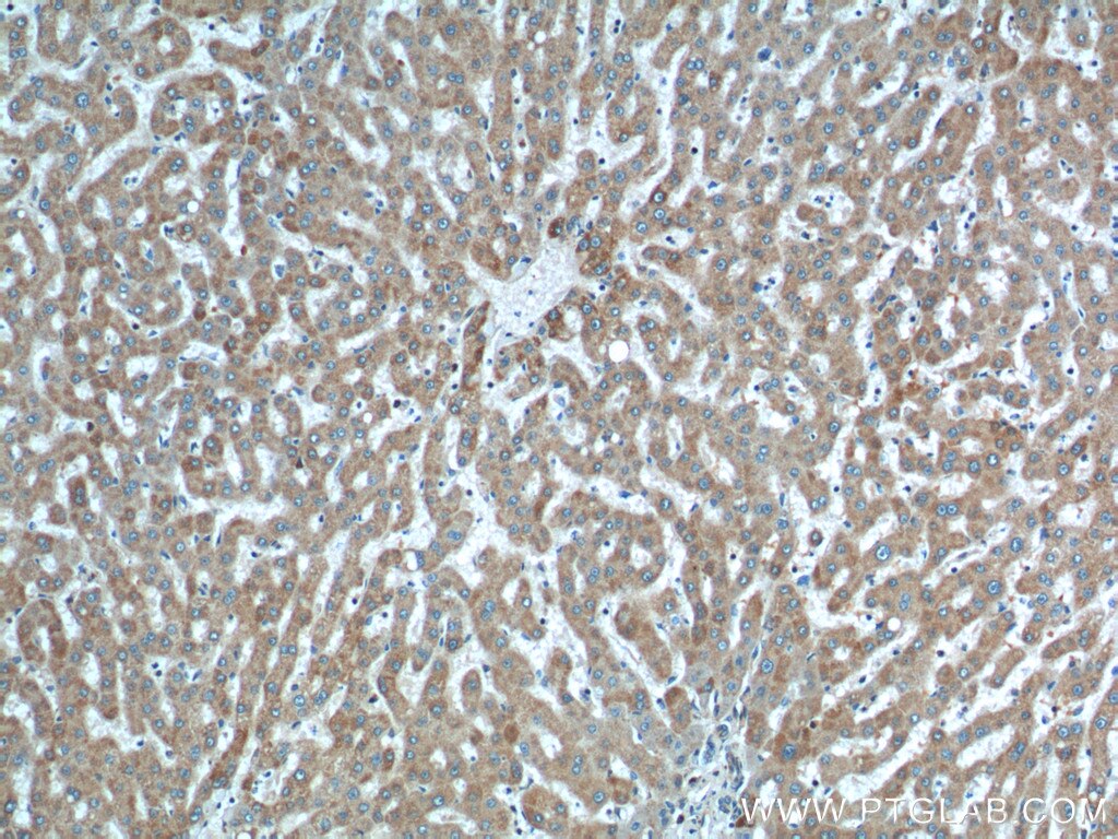 Immunohistochemistry (IHC) staining of human liver tissue using SLC25A6-Specific Polyclonal antibody (14841-1-AP)