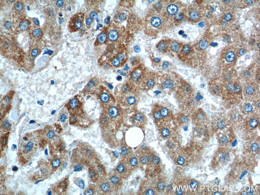 Immunohistochemistry (IHC) staining of human liver tissue using SLC25A6-Specific Polyclonal antibody (14841-1-AP)