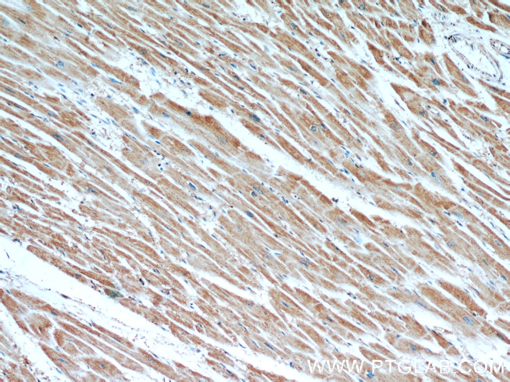 Immunohistochemistry (IHC) staining of human heart tissue using SLC25A6-Specific Polyclonal antibody (14841-1-AP)