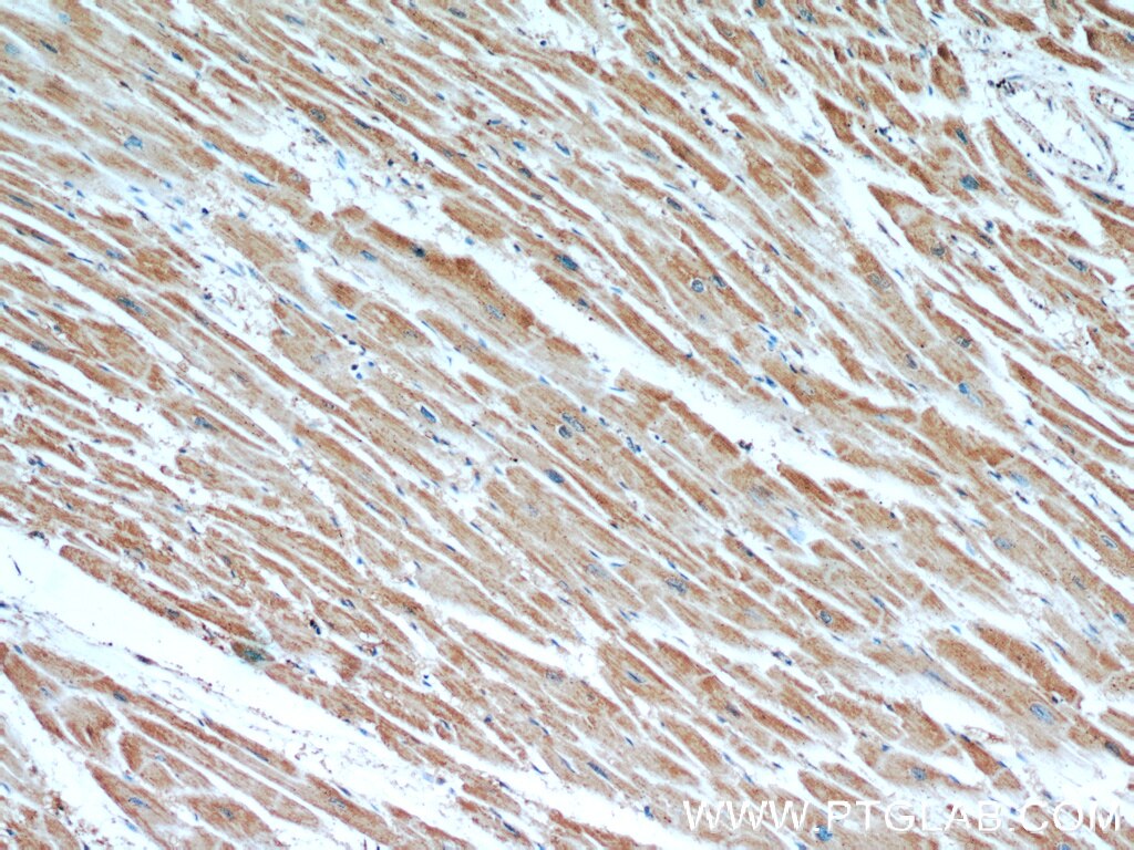 IHC staining of human heart using 14841-1-AP