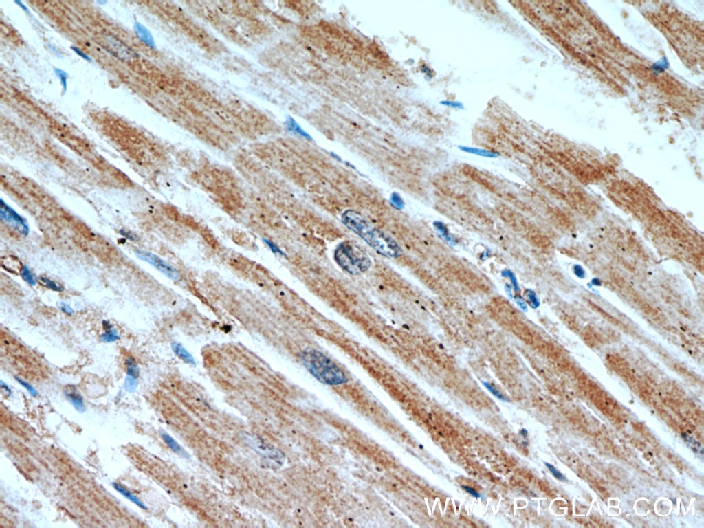 Immunohistochemistry (IHC) staining of human heart tissue using SLC25A6-Specific Polyclonal antibody (14841-1-AP)