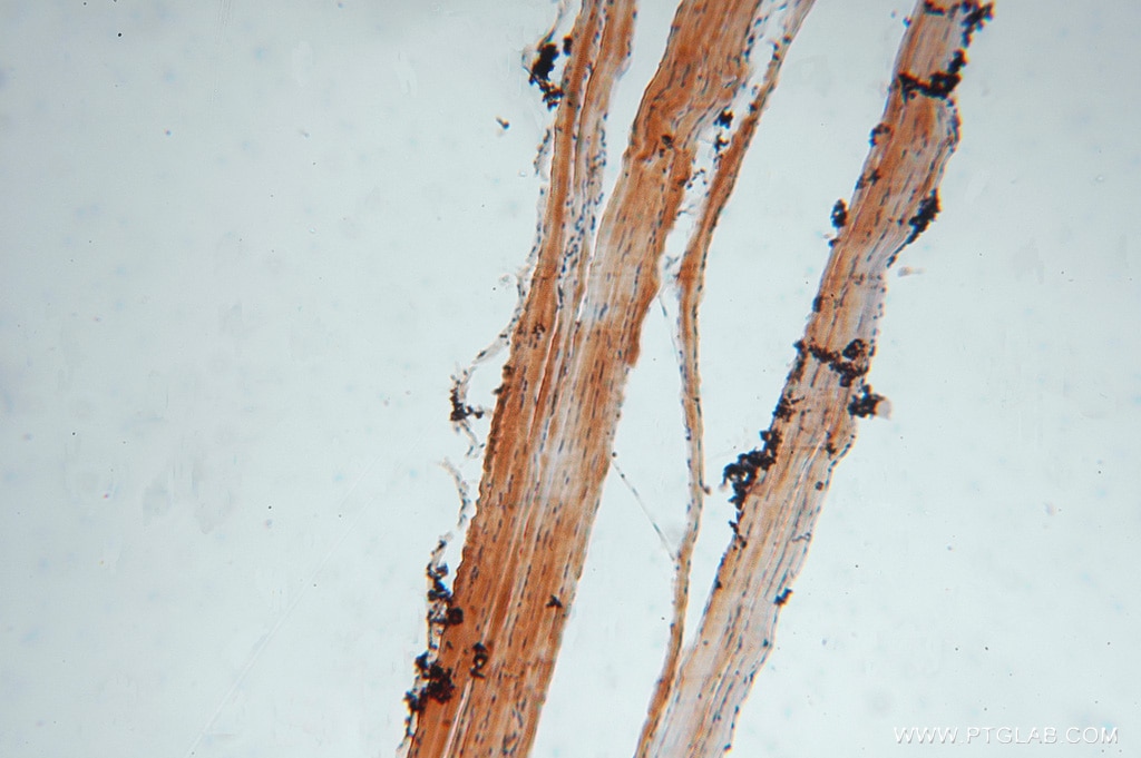 Immunohistochemistry (IHC) staining of human skeletal muscle tissue using SLC25A6-Specific Polyclonal antibody (14841-1-AP)
