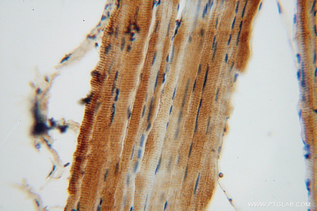 Immunohistochemistry (IHC) staining of human skeletal muscle tissue using SLC25A6-Specific Polyclonal antibody (14841-1-AP)