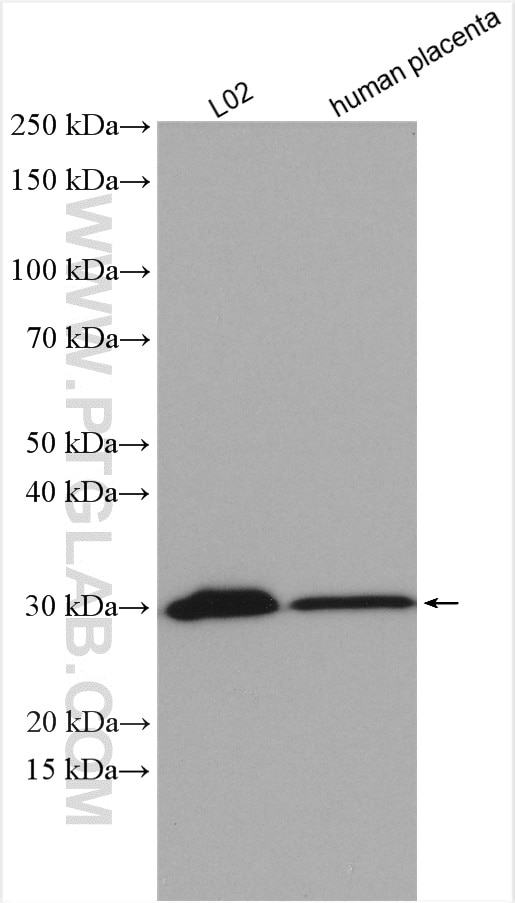 Western Blot (WB) analysis of various lysates using SLC25A6-Specific Polyclonal antibody (14841-1-AP)