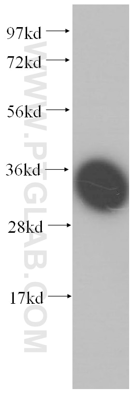 Western Blot (WB) analysis of human liver tissue using SLC25A6-Specific Polyclonal antibody (14841-1-AP)