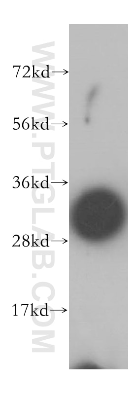 Western Blot (WB) analysis of human heart tissue using SLC25A6-Specific Polyclonal antibody (14841-1-AP)