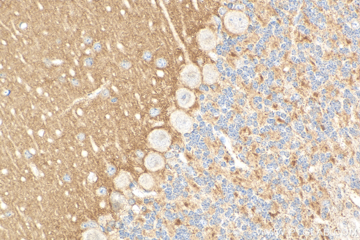 Immunohistochemistry (IHC) staining of mouse cerebellum tissue using SLC26A11 Polyclonal antibody (14156-1-AP)