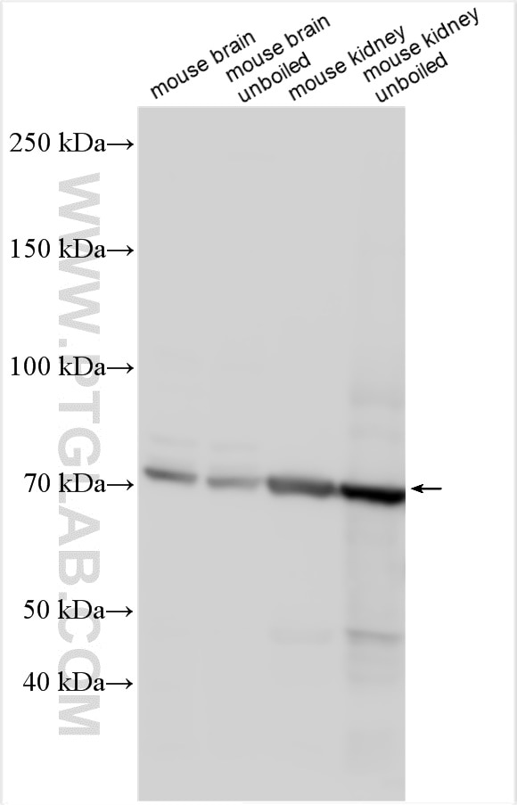 Western Blot (WB) analysis of various lysates using SLC26A11 Polyclonal antibody (14156-1-AP)