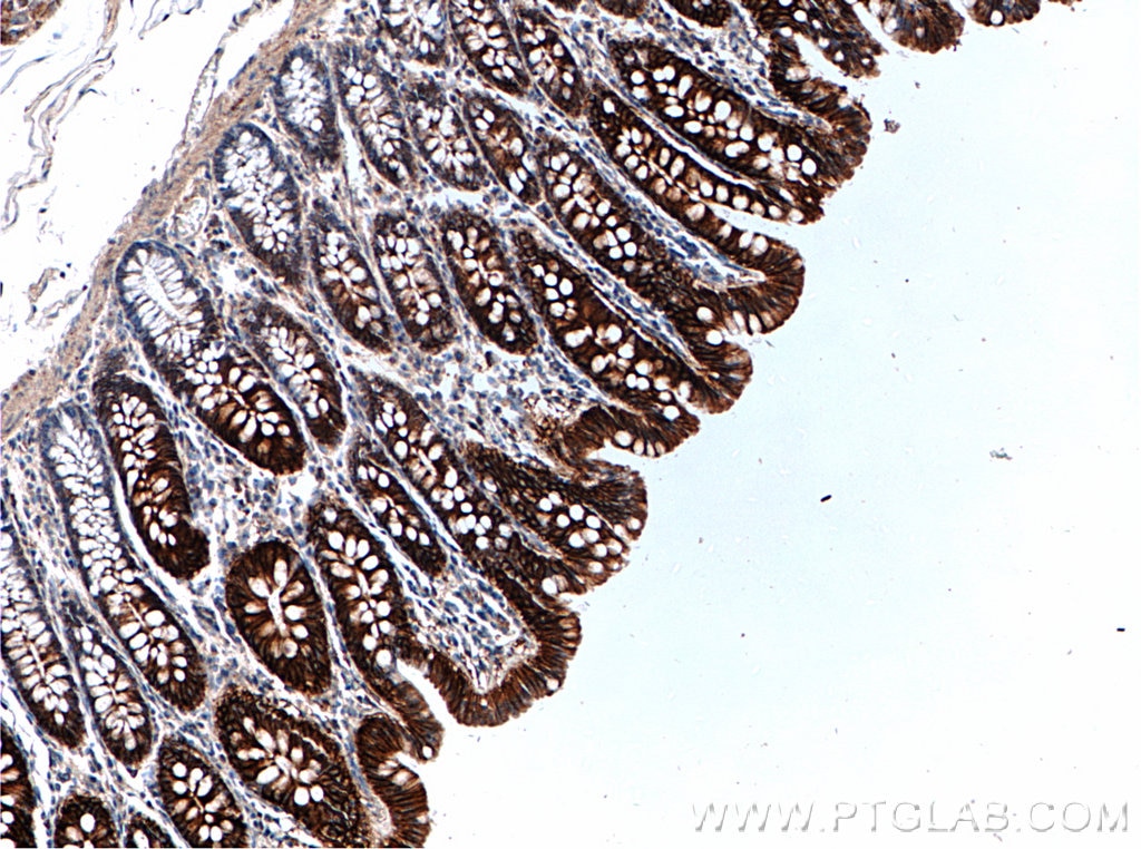 IHC staining of human colon using 27759-1-AP