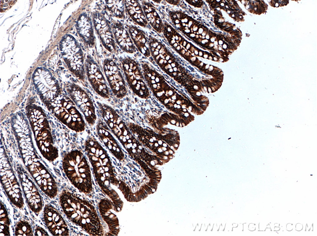 Immunohistochemistry (IHC) staining of human colon tissue using SLC26A2 Polyclonal antibody (27759-1-AP)