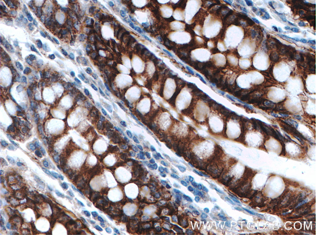IHC staining of human colon using 27759-1-AP