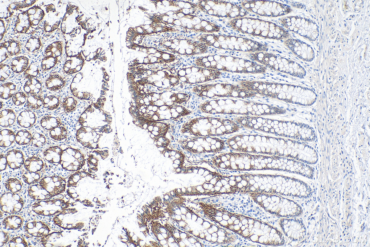 Immunohistochemistry (IHC) staining of human colon tissue using SLC26A2 Polyclonal antibody (27759-1-AP)