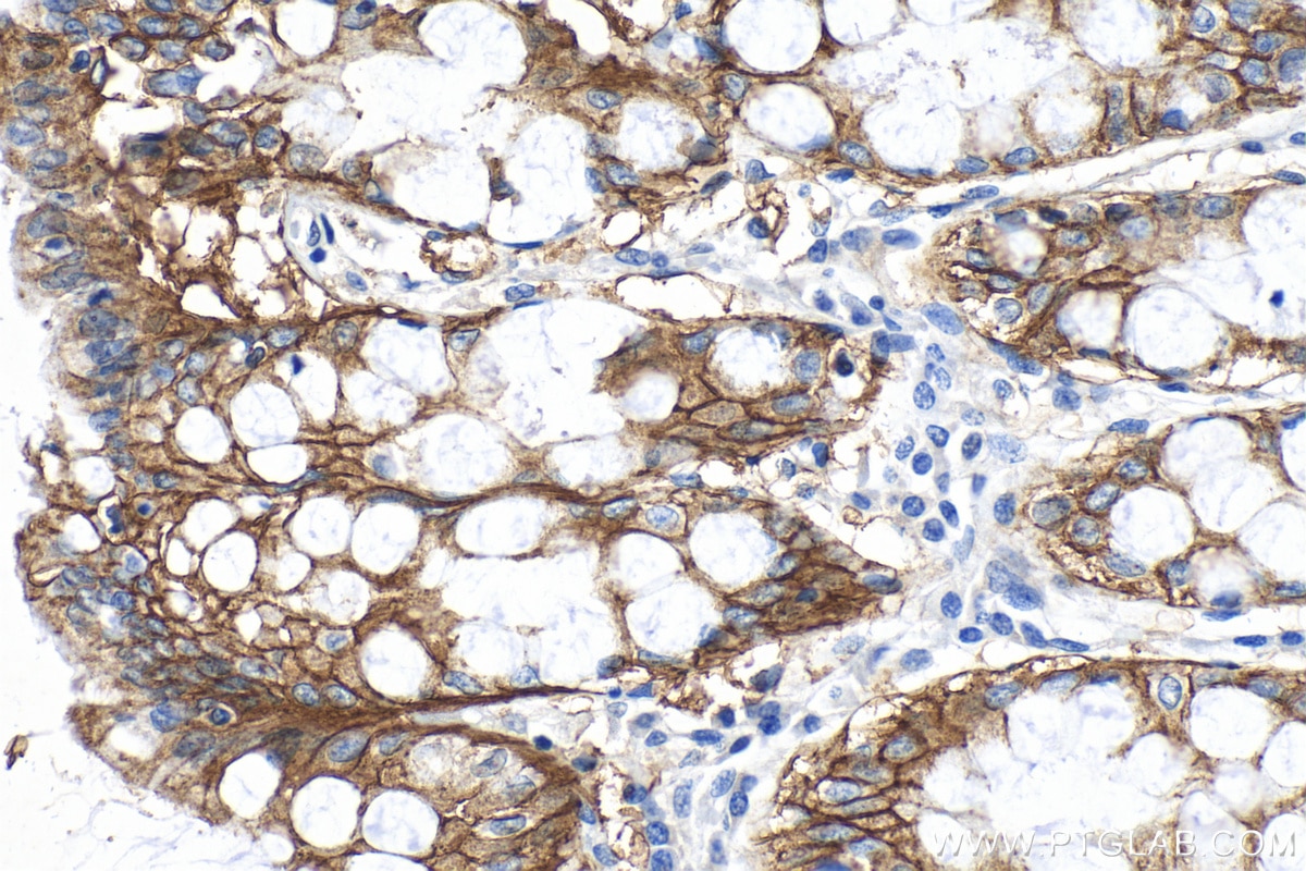 IHC staining of human colon using 27759-1-AP