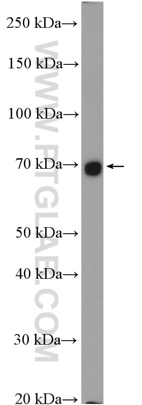 Western Blot (WB) analysis of mouse colon tissue using SLC26A2 Polyclonal antibody (27759-1-AP)
