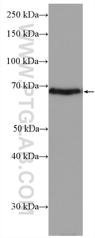 Western Blot (WB) analysis of rat colon tissue using SLC26A2 Polyclonal antibody (27759-1-AP)