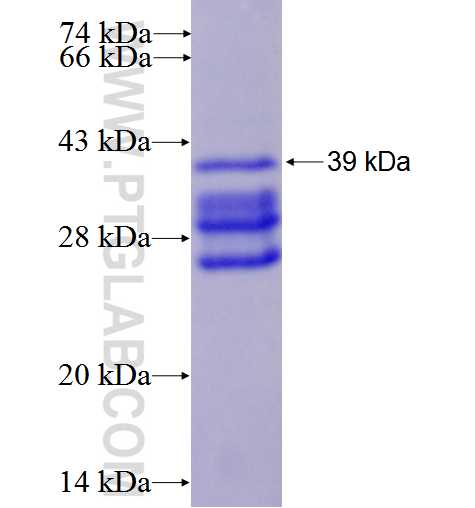 SLC26A2 fusion protein Ag26521 SDS-PAGE