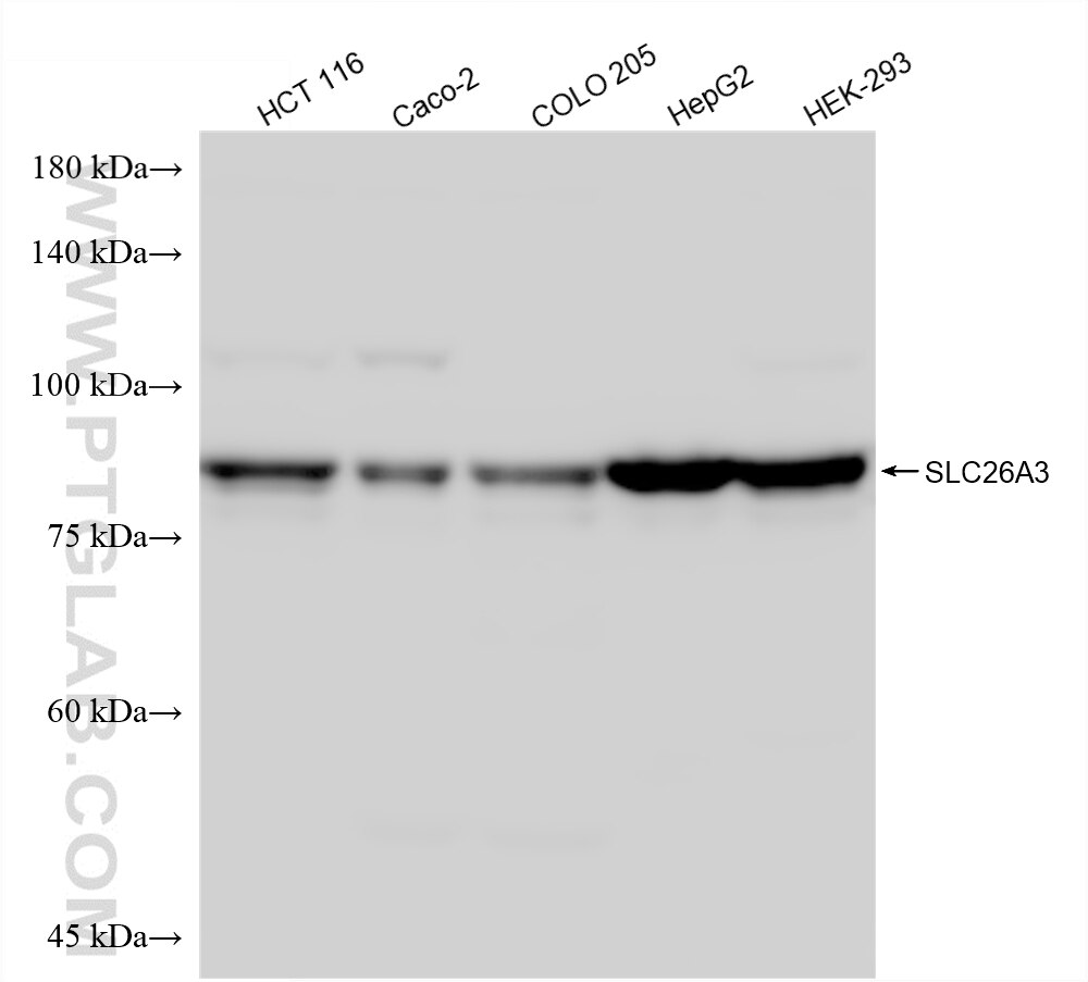 Western Blot (WB) analysis of various lysates using SLC26A3 Recombinant monoclonal antibody (87216-1-RR)