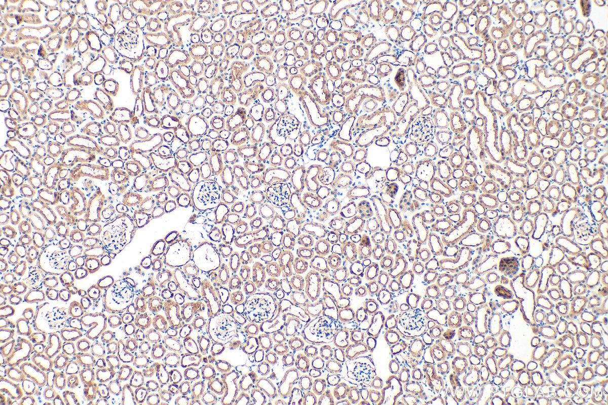 Immunohistochemical analysis of paraffin-embedded mouse kidney tissue slide using 22726-1-AP (SLC26A4 antibody) at dilution of 1:200 (under 10x lens). Heat mediated antigen retrieval with Tris-EDTA buffer (pH 9.0). Immunohistochemistry (IHC) staining of mouse kidney tissue using SLC26A4 Polyclonal antibody (22726-1-AP)
