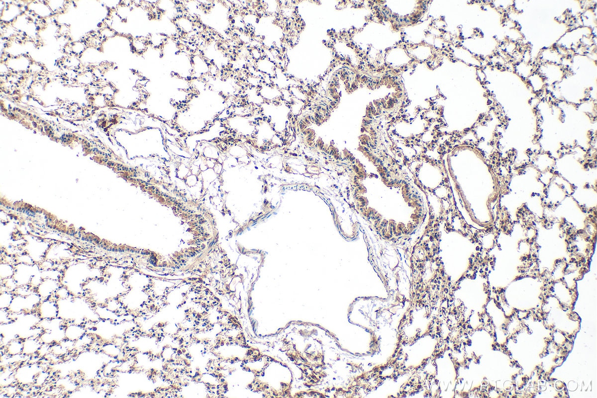 Immunohistochemical analysis of paraffin-embedded mouse lung tissue slide using 22726-1-AP (SLC26A4 antibody) at dilution of 1:200 (under 10x lens). Heat mediated antigen retrieval with Tris-EDTA buffer (pH 9.0). Immunohistochemistry (IHC) staining of mouse lung tissue using SLC26A4 Polyclonal antibody (22726-1-AP)