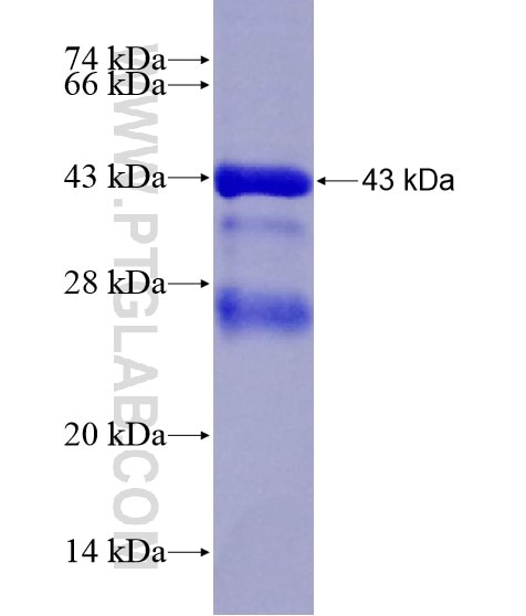 SLC26A4 fusion protein Ag18622 SDS-PAGE