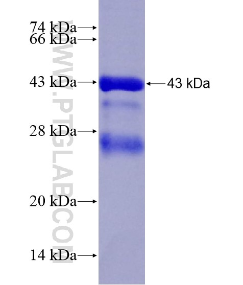 SLC26A4 fusion protein Ag18622 SDS-PAGE SLC26A4 fusion protein Ag18622 SDS-PAGE
