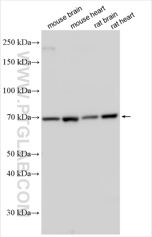 Western Blot (WB) analysis of various lysates using SLC26A5 Polyclonal antibody (22013-1-AP)