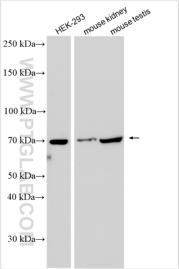 Western Blot (WB) analysis of various lysates using SLC26A7 Polyclonal antibody (17654-1-AP)