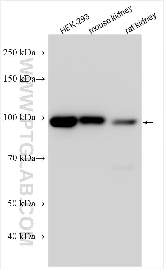 Western Blot (WB) analysis of various lysates using SLC26A7 Polyclonal antibody (17654-1-AP)